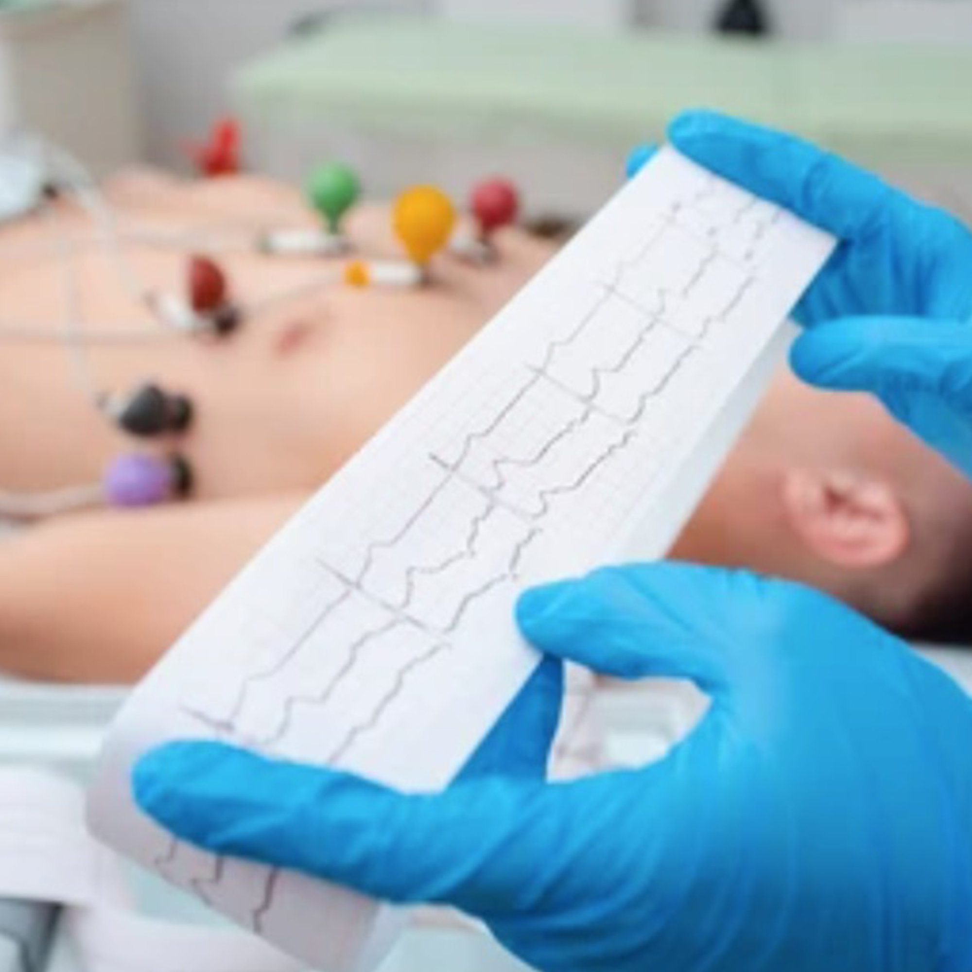 Default Category International/Orvosi gyakorlat/Fogyóeszközök EKG/ECG, Ultrahang