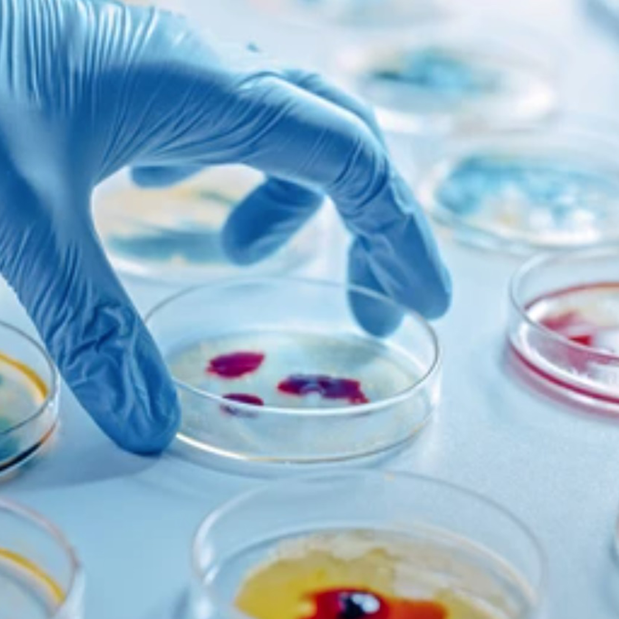 Orvosi Laboratórium/Laboratóriumi Kellékek/Petri Csészék