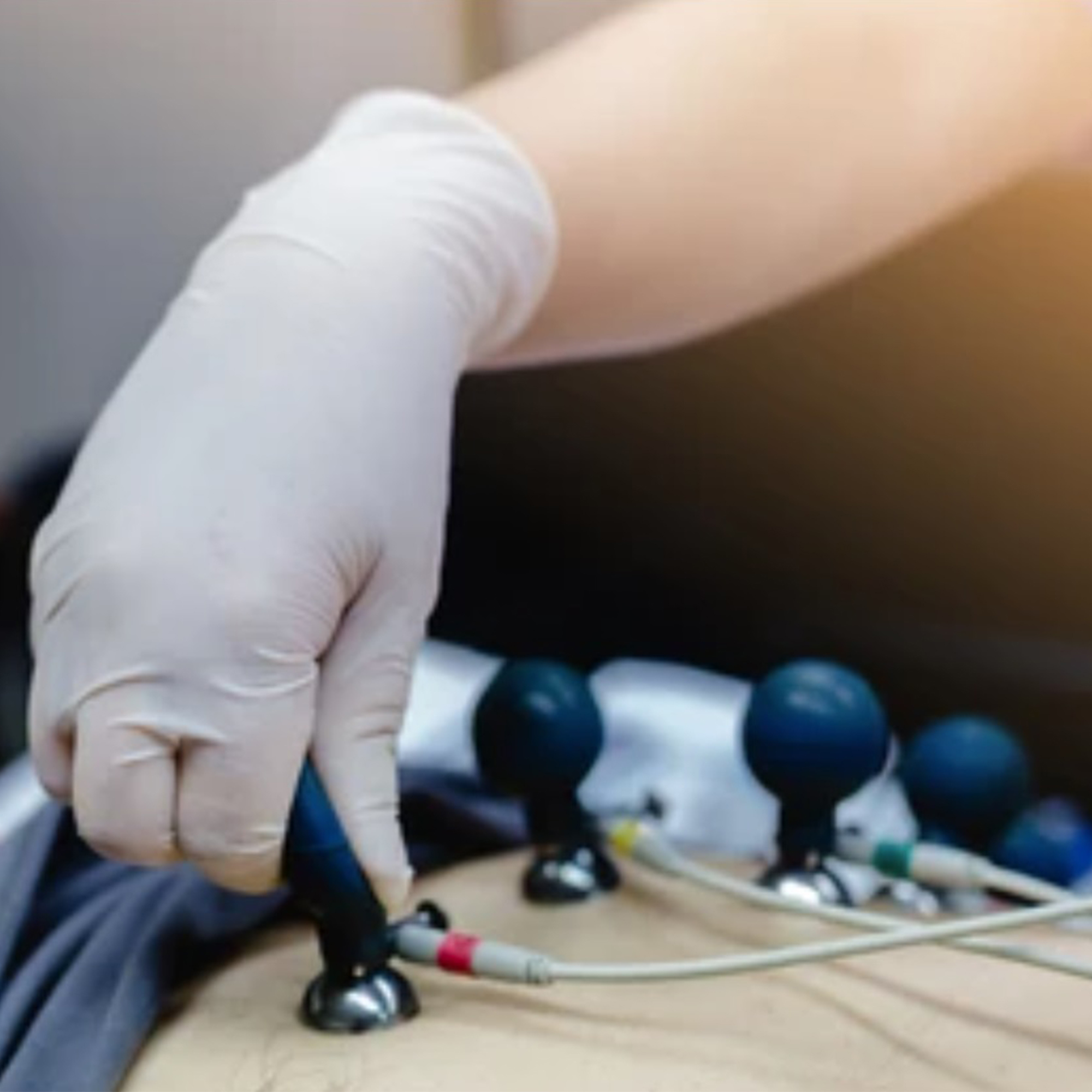 Orvosi gyakorlat/Fogyóeszközök EKG/ECG, Ultrahang/EKG/ECG Elektródák