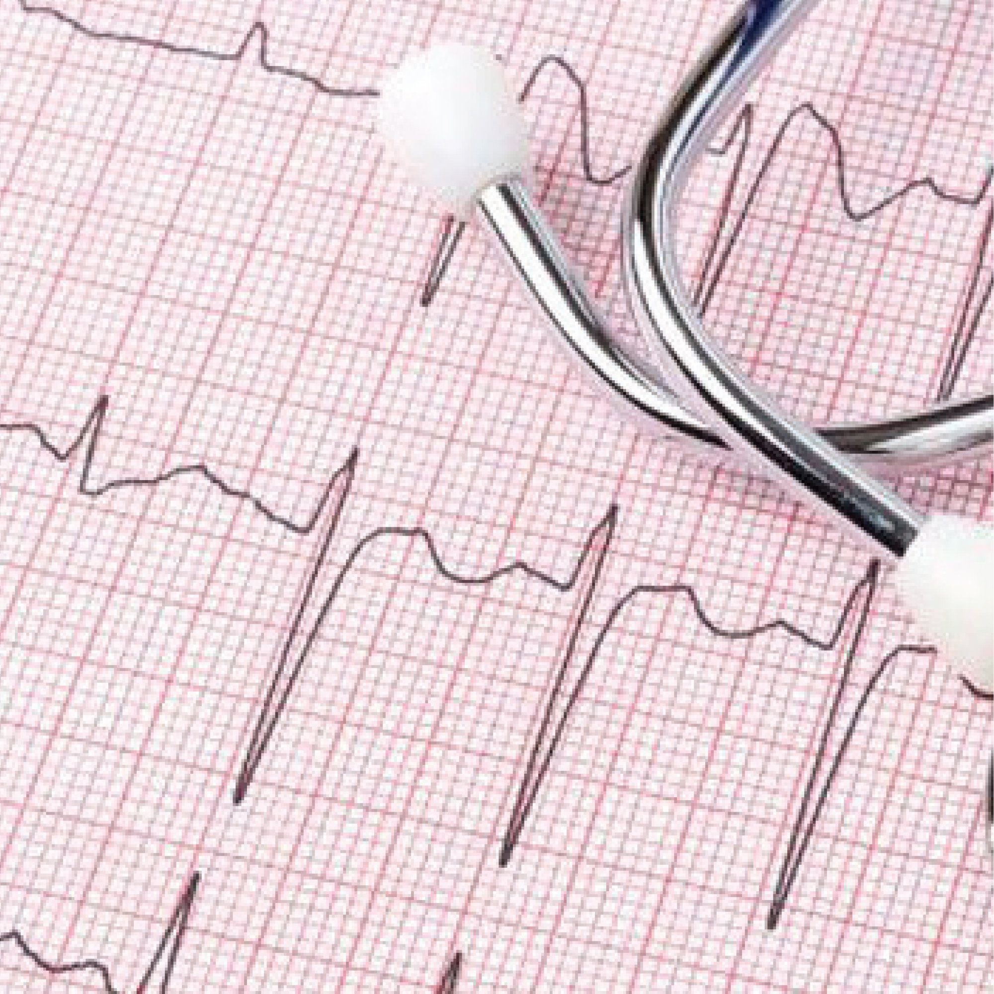 Orvosi gyakorlat/Fogyóeszközök EKG/ECG, Ultrahang/EKG/ECG Papír